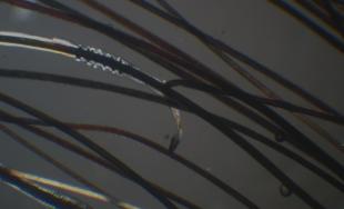Imagem microscópica: Sinais de lático / esqualene