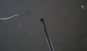 Imagem microscópica: Anágeno