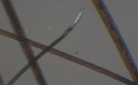 Imagem microscópica: Padrão sem bulbo