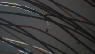 Imagem microscópica: Anágeno distrófico