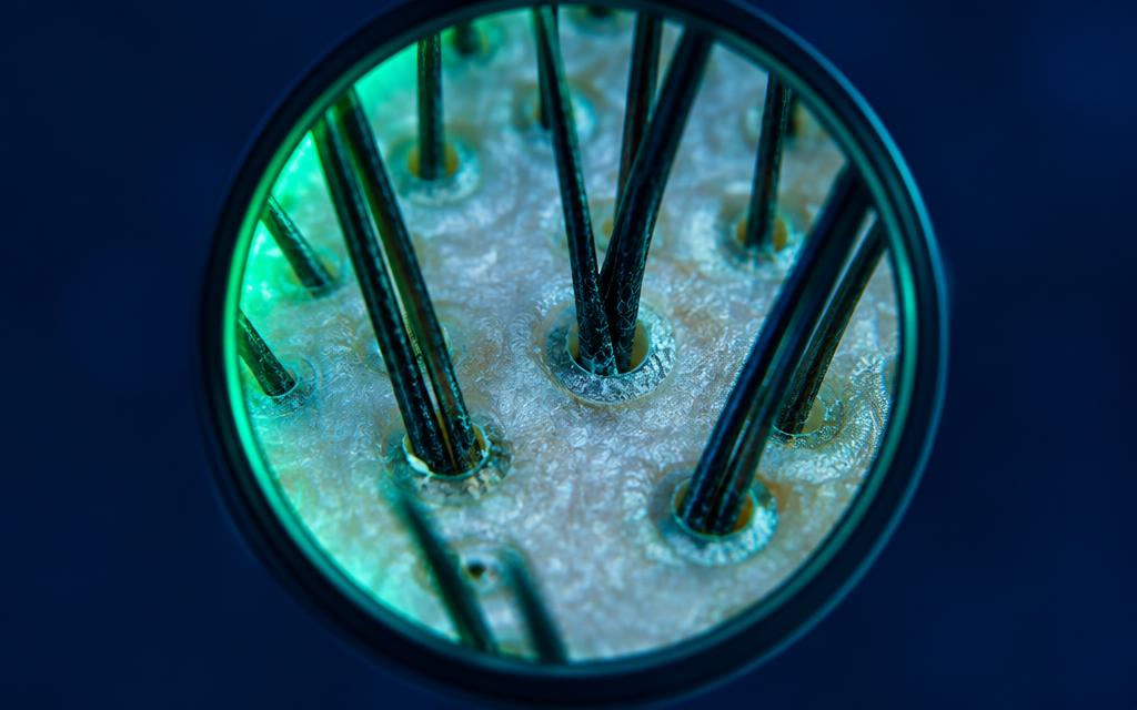 Dermatoscopia / Tricoscopia Digital